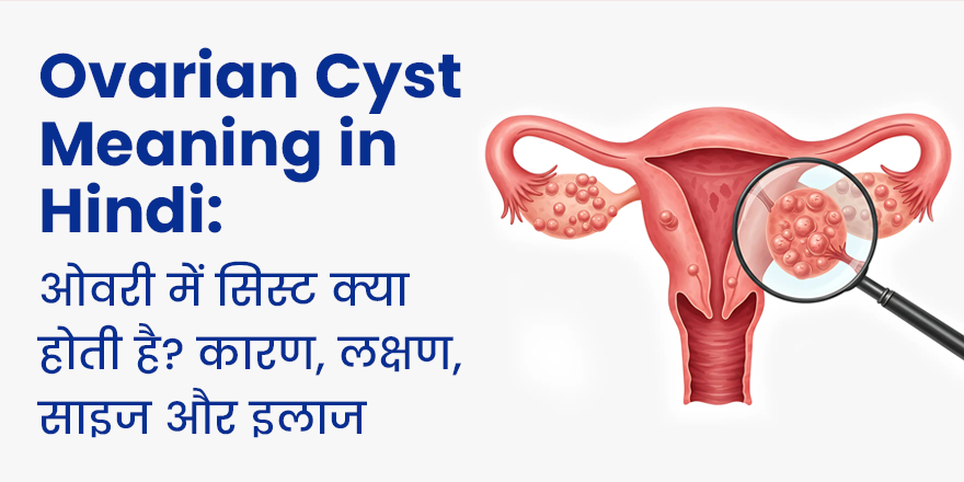 Ovarian Cyst Meaning in Hindi: ओवरी में सिस्ट क्यों होती है, लक्षण, कारण और इलाज